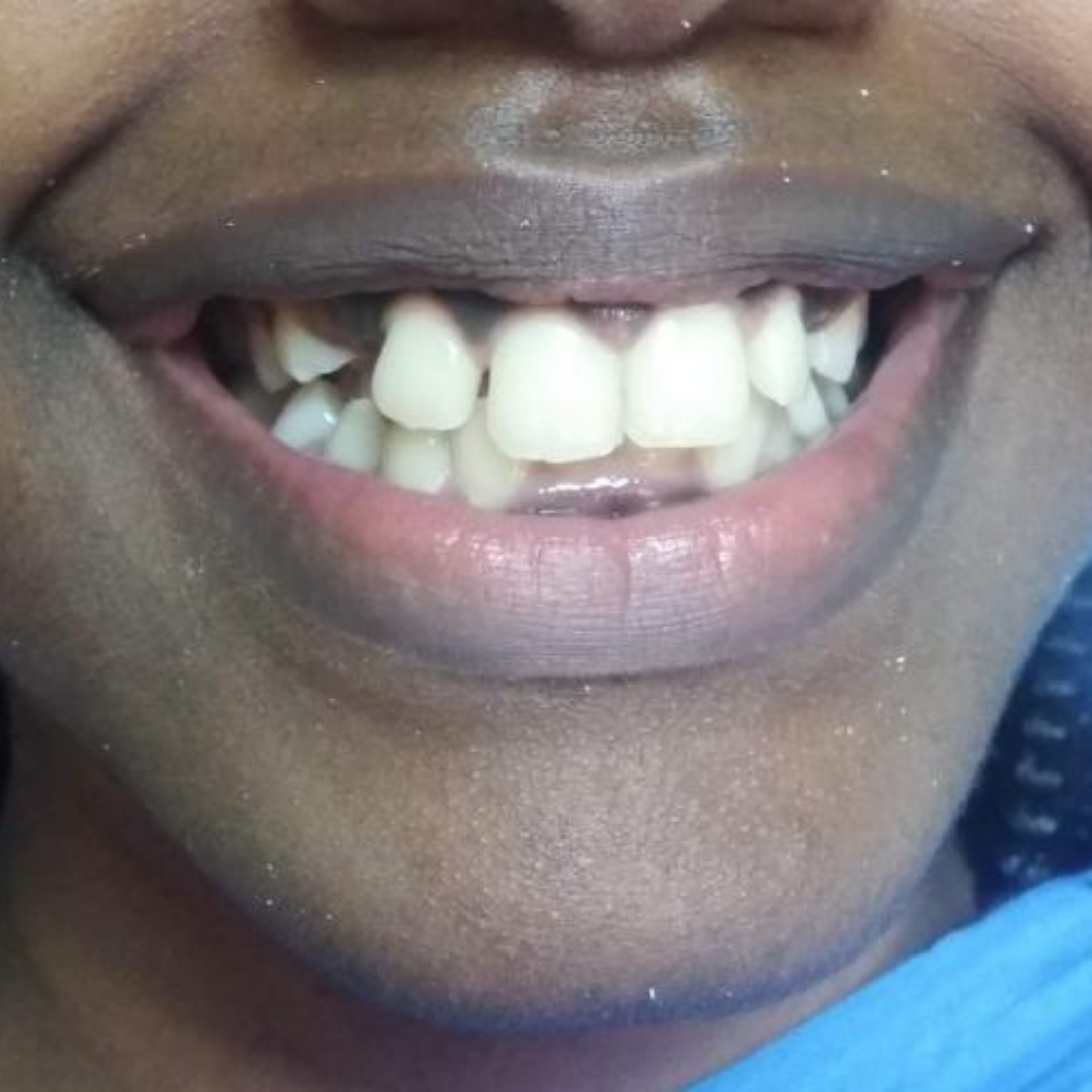 Before